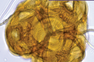 FICHE Palyno : Notions de base en palynogénèse et morphologie du pollen